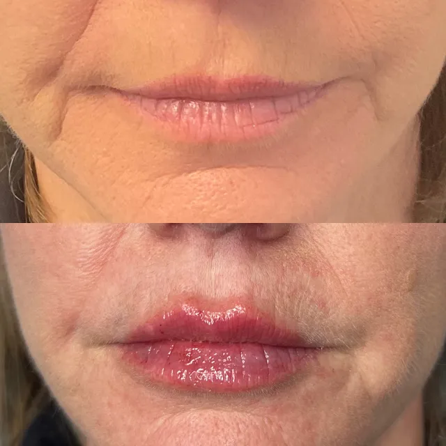 Skin Verse Medical Spa