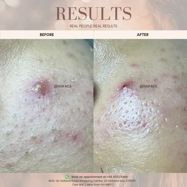 SGFACE Medispa - European Skincare Powered by Advanced Technology (Holland Village)