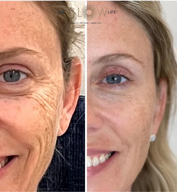 The Glow Life Med-Spa