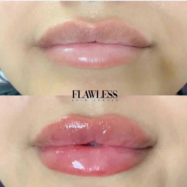 Flawless Skin Center - Sherman Oaks: Med Spa