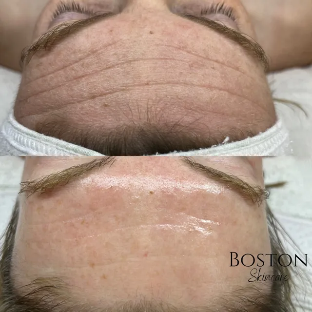 Boston Skincare