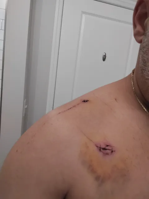 photo-2