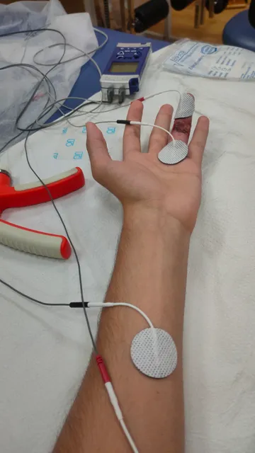 Fisioterapia Alberto de la Fuente (a domicilio)