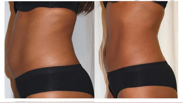 Magic Body sculpture