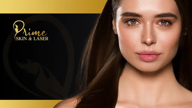 Prime Skin and Laser