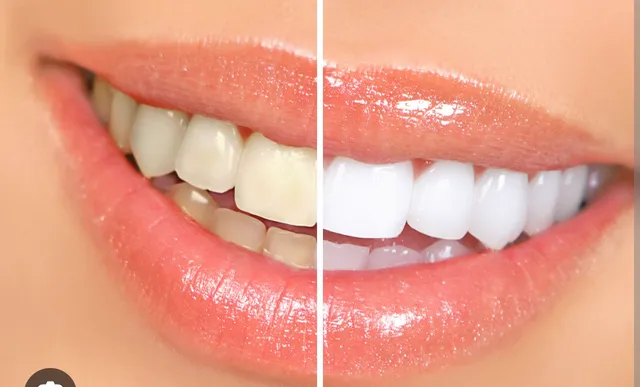 Beauté Bio d'Or - Institut de Beauté Bio Paris 12