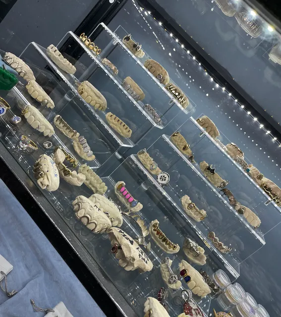 Luxe Grillz: Diamond & Gold Grillz