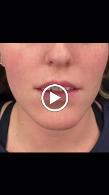 Cupertino Facial Esthetics