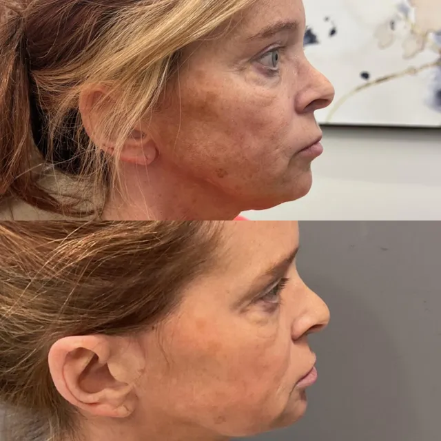 Healthylooks Med Spa & Wellness