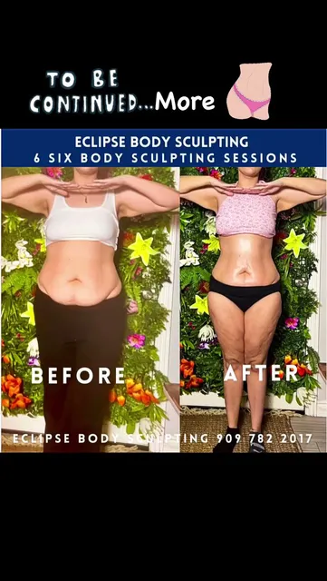 Eclipse Body Sculpting Studio