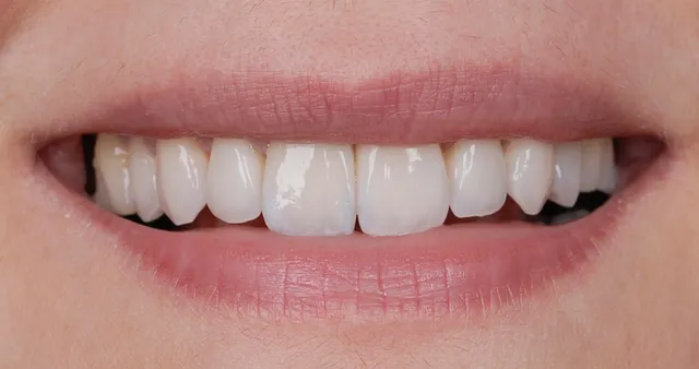 ArtLab Dentistry Brentwood