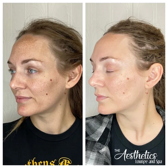 The Palm Medspa + Wellness