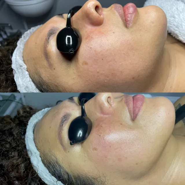 Angel’s Skin Care Specialist