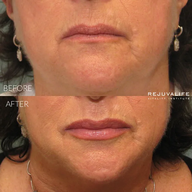 Rejuvalife Vitality Institute