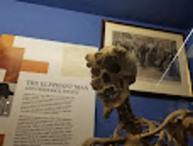 The Royal London Hospital Museum