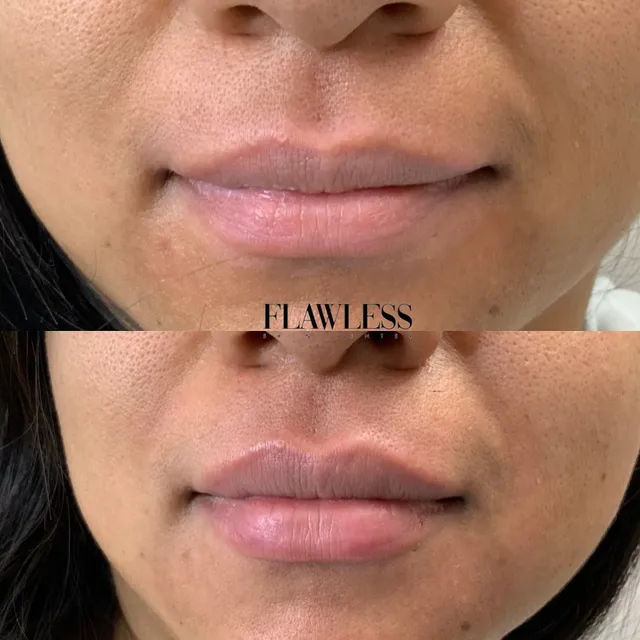 Flawless Skin Center - Glendale: Med Spa