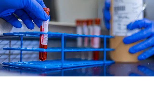 Grifols Freedom Plasma Donation Center - Hueytown