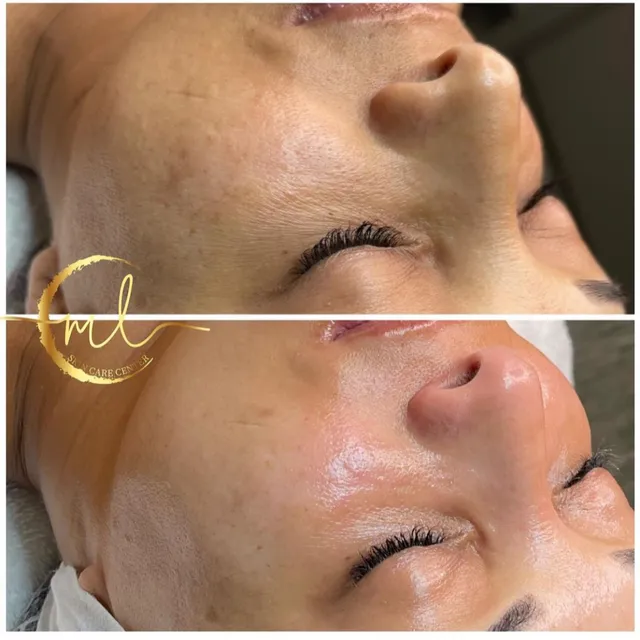 ML Skincare Center