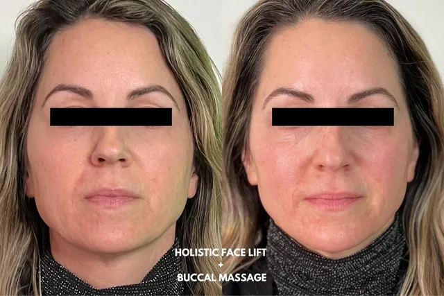 Altru Radiance - Aesthetic Wellness