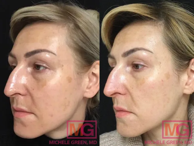 Dr. Michele Green, M.D.