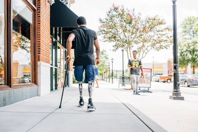 Limbionics of Raleigh