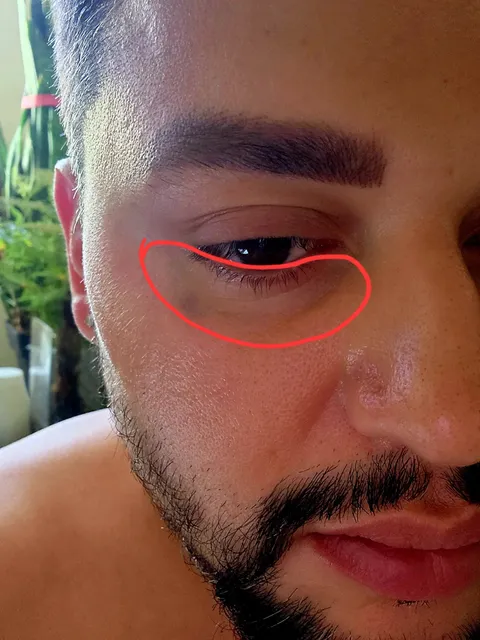 YouthFill MD Med Spa - Beverly Hills