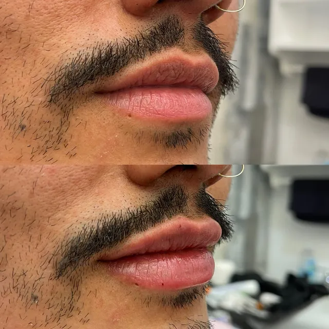 My Youth Med Spa — Bruce Dizon, RN