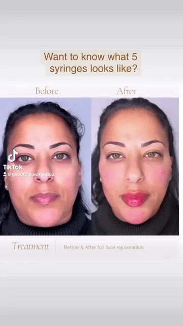 Good To Glow Med Spa and Wellness