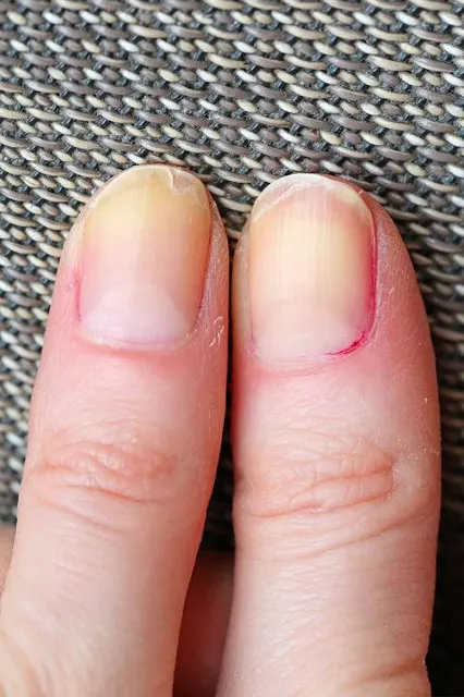 gmina Bytom Odrzański