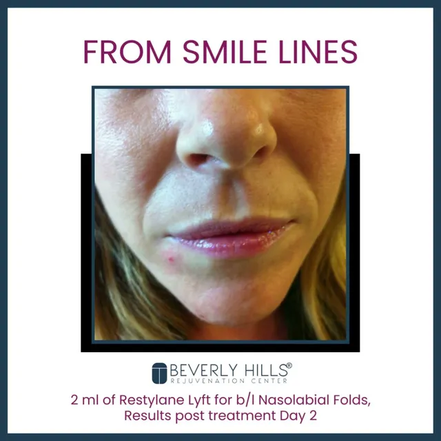 Beverly Hills Rejuvenation Center Dominion Creek