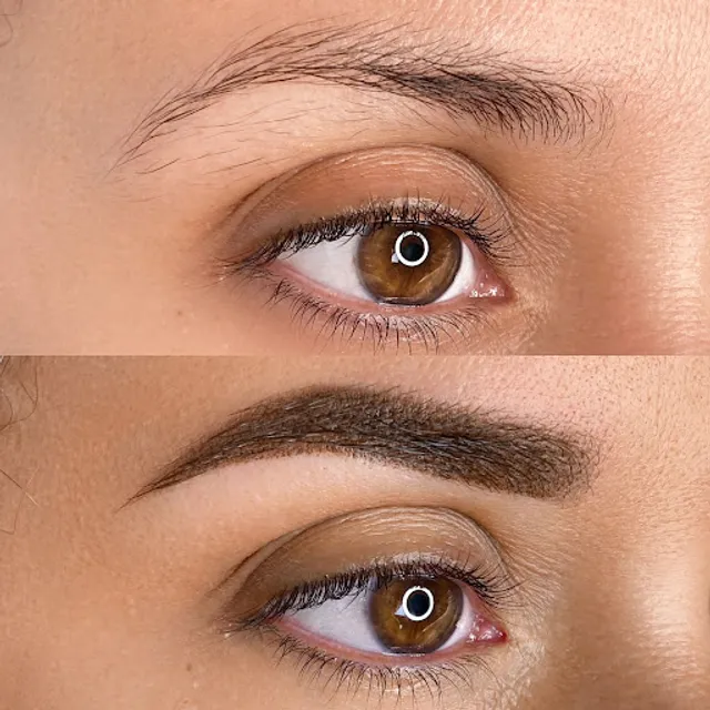 SkinDose MedSpa - Botox, Lip Filler, & PRP in Queens