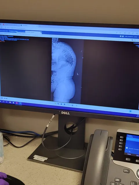 Zeeshan M. Sardar, MD