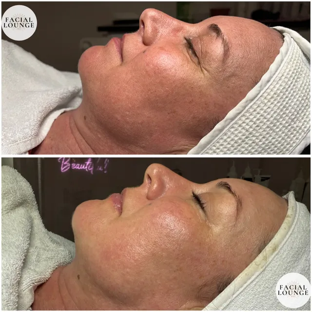 The Facial Lounge OKC