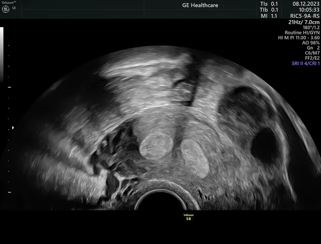 Ginecólogo en Sevilla Dr. Rufino García-Otero