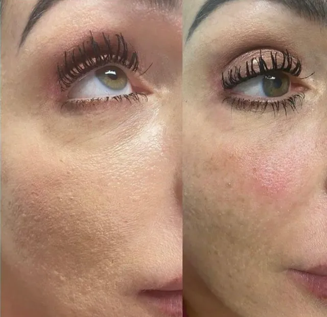 Advanced Cosmesis Med Spa Bayonne, NJ