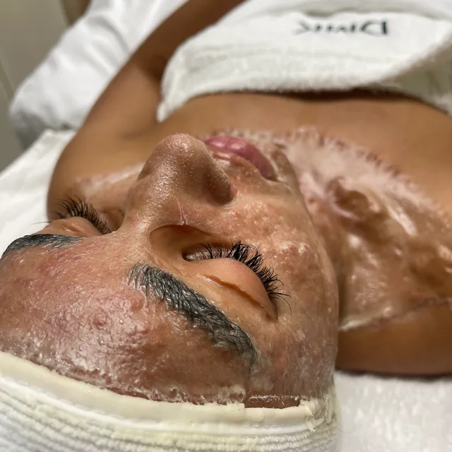 Evolution Skyn Aesthetics - Dermaplaning + Acne Expert + DMK Facialist