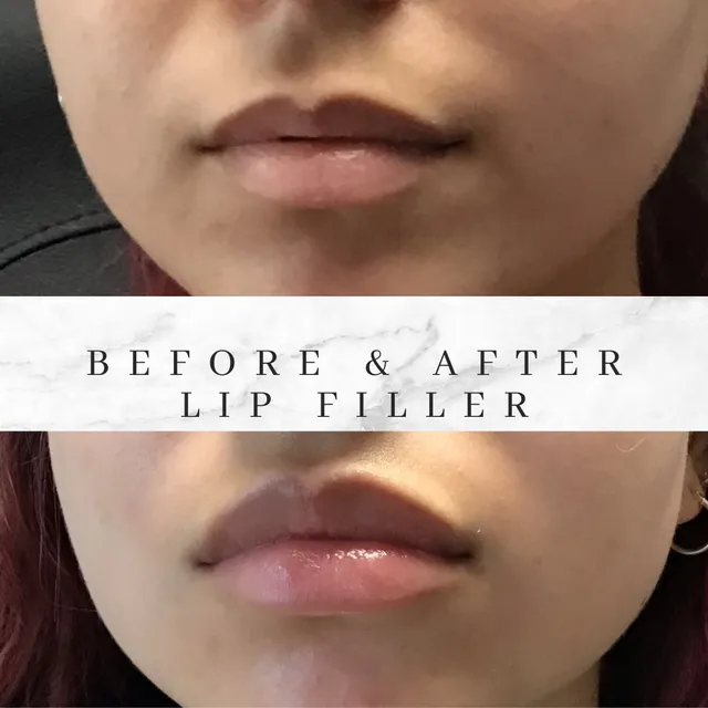 University Dermatology Center: Jen Justus( Nurse Injector)