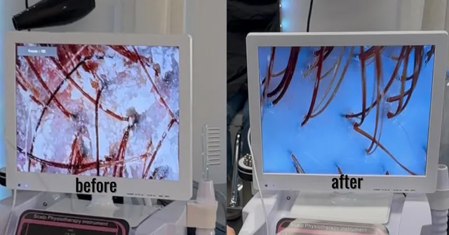 The Scalp Lounge Hair Loss & Wellness