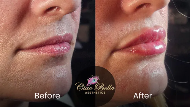 Ciao Bella Aesthetics