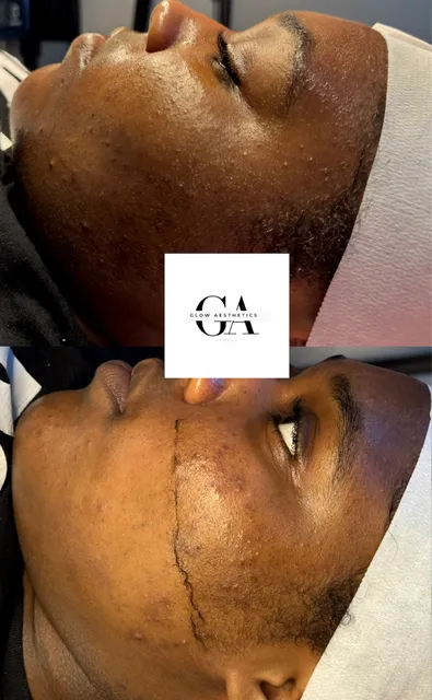 Glow Aesthetics Studio