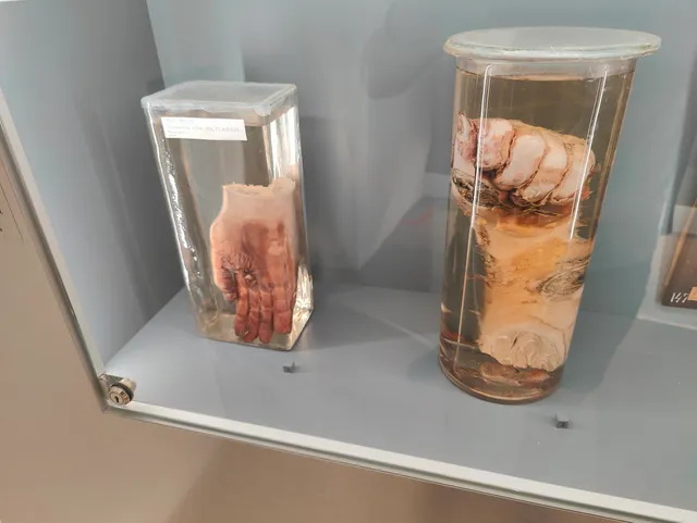 Museo de Anatomía y Patología de la universidad de Viena