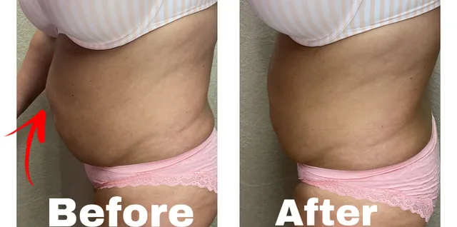 Body Master Contouring