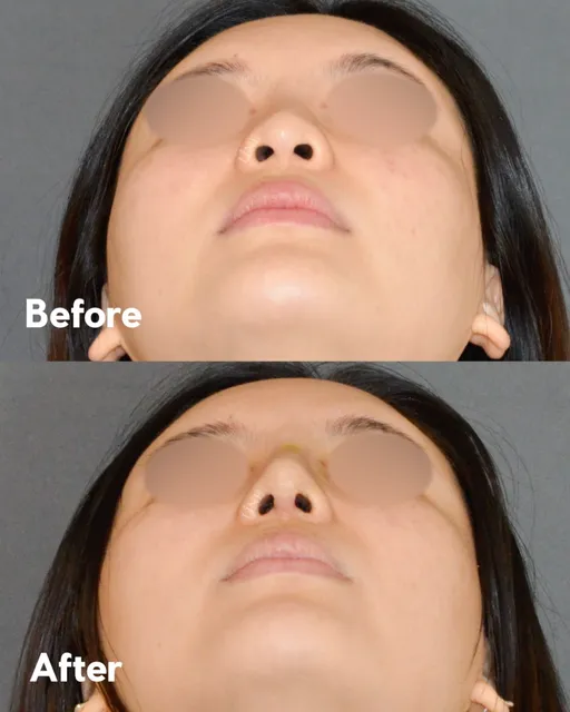 Line Plastic Surgery Center