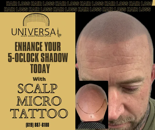 Universal Scalp Micro Pigmentation