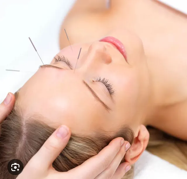 Chang’An Acupuncture and Wellness