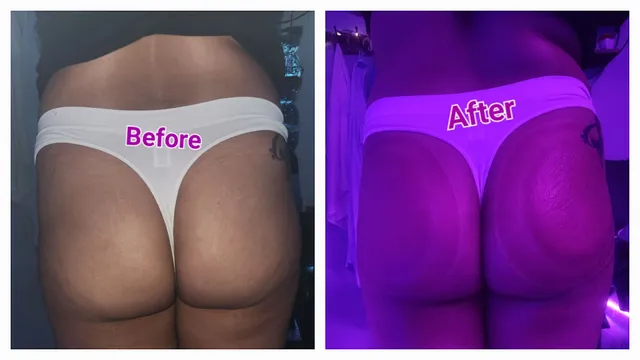 Visualize Goals Body Contouring Studio