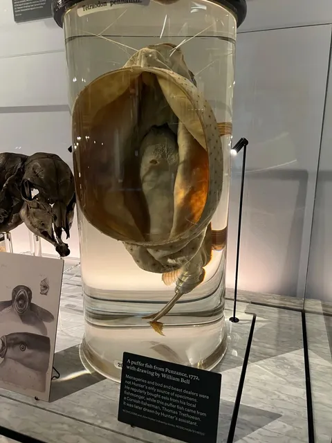 🩺 Hunterian Museum: A Macabre Marvel of Medical History!