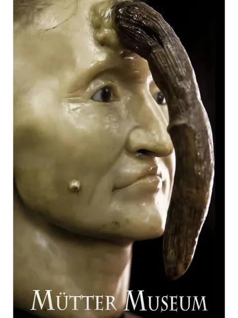 The One and Only in the World - The Unique Mütter Museum 🏟😅👩‍⚕️